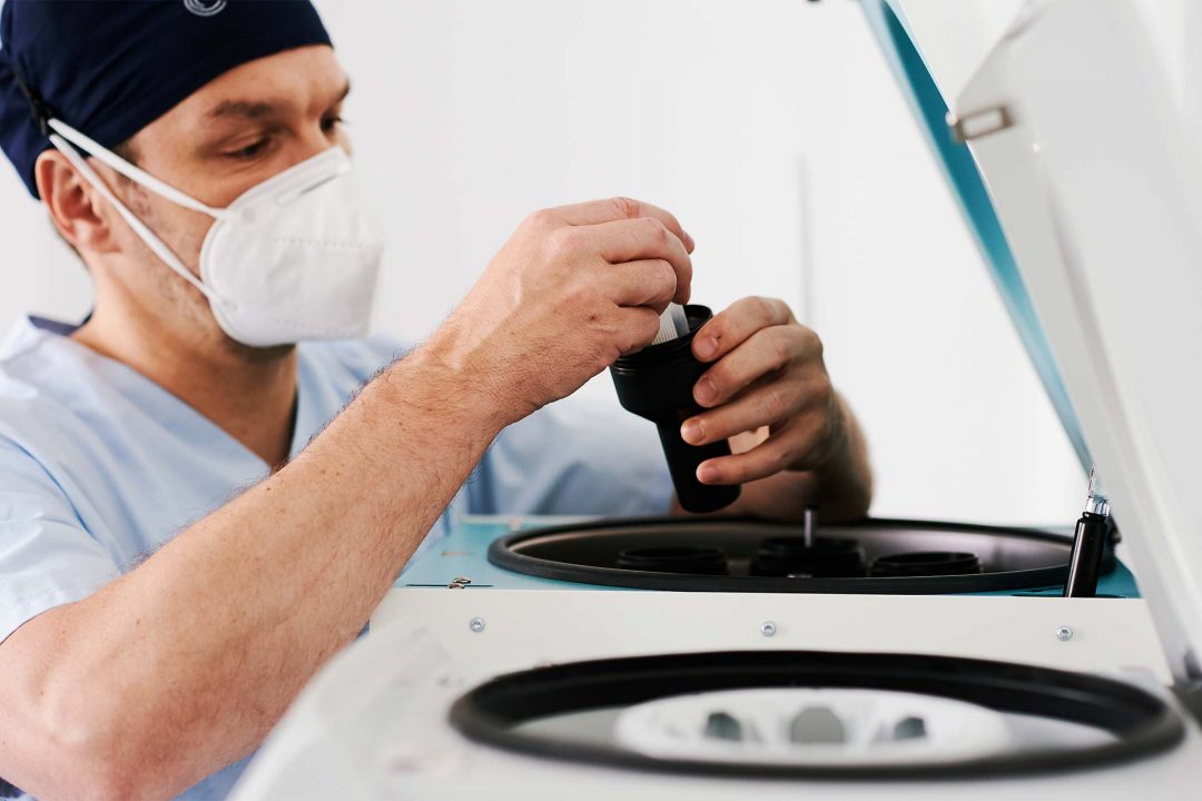 Fettstammzellen Therapie bei Haarausfall